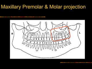 Intra Oral radiographic anatomical landmarks | PPT