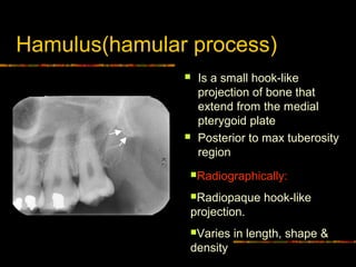 Hamulus Intra Oral radiographic anatomical landmarks | PPT