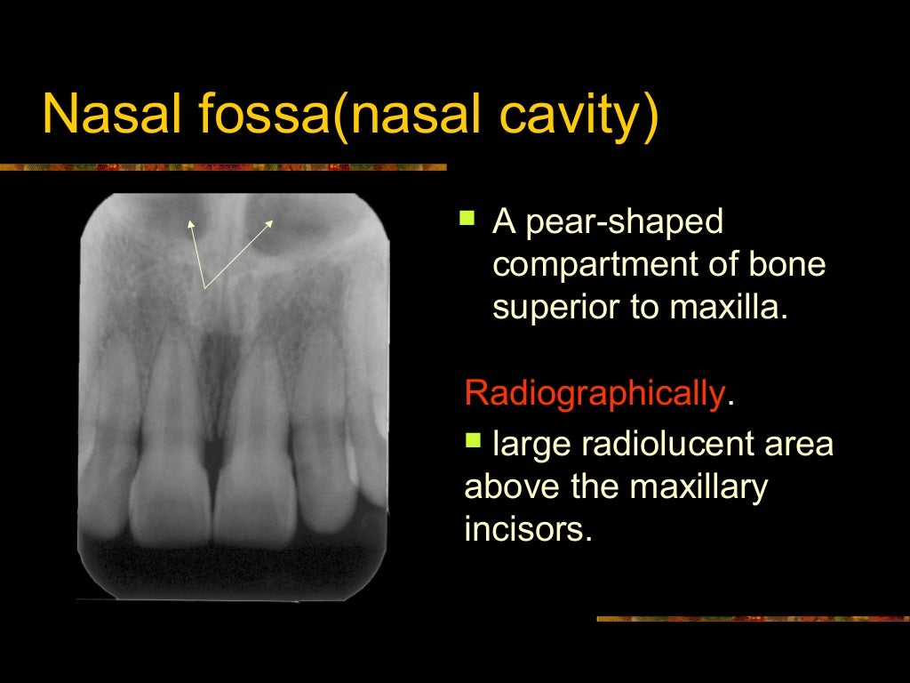 Intra Oral radiographic anatomical landmarks