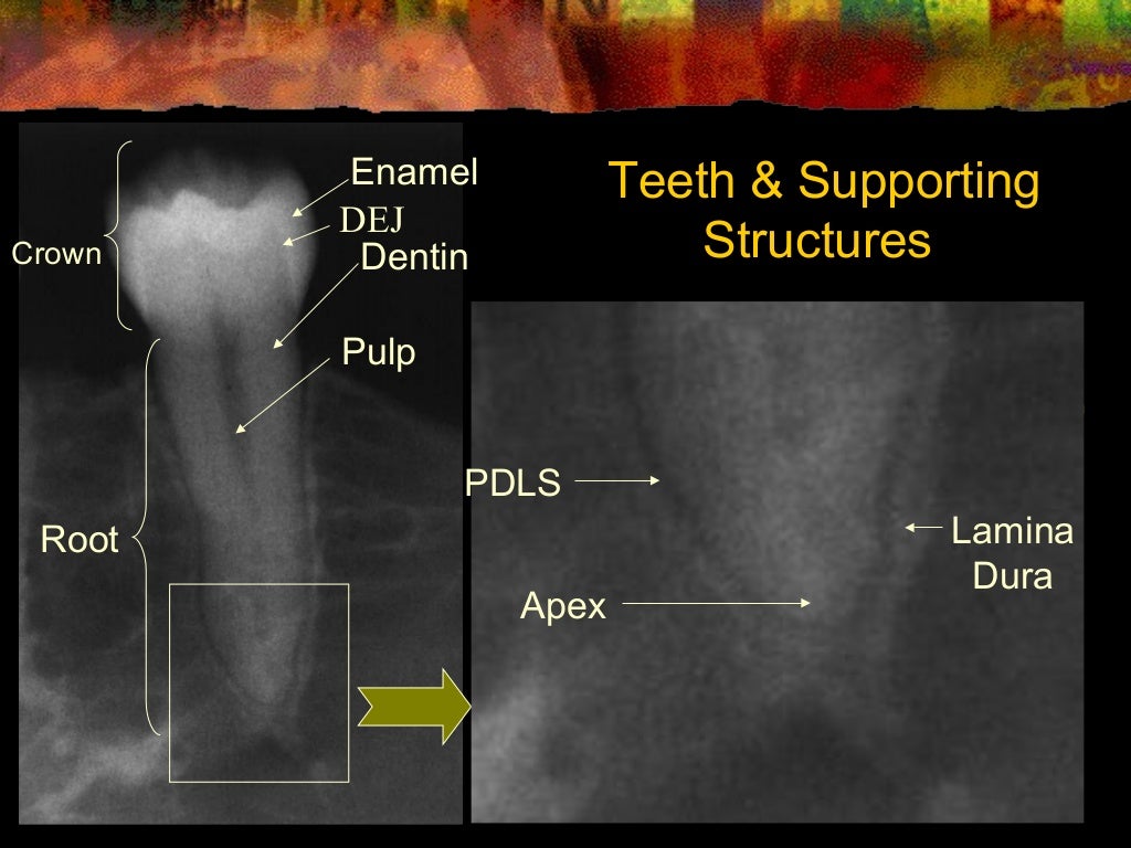 Intra Oral radiographic anatomical landmarks