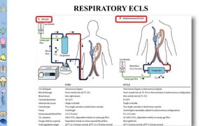 BEACH 2019 – FS Taccone
T1T2T3T4T5T6
T7T8
T9
T10
T11T12L1L2L3
RESPIRATORY ECLS
 