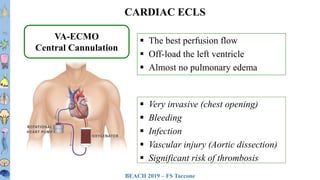 BEACH 2019 – FS Taccone
T1T2T3T4T5T6
T7T8
T9
T10
T11T12L1L2L3
 The best perfusion flow
 Off-load the left ventricle
 Almost no pulmonary edema
 Very invasive (chest opening)
 Bleeding
 Infection
 Vascular injury (Aortic dissection)
 Significant risk of thrombosis
CARDIAC ECLS
VA-ECMO
Central Cannulation
 