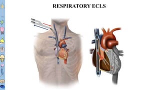 BEACH 2019 – FS Taccone
T1T2T3T4T5T6
T7T8
T9
T10
T11T12L1L2L3
RESPIRATORY ECLS
 