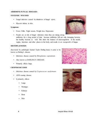 8 Amjad Khan Afridi
AIRBORNE FUNGAL DISEASES
SYSTEMIC MYCOSIS
• Fungal infection caused by inhalation of fungal spore,
• Mycosis initiate in skin.
Symptoms:
• Fever, Chills, Night sweats, Weight loss, Depression
• People are at risk of fungal infections when they are taking strong
antibiotics for a long period of time because antibiotics kill not only damaging bacteria,
but healthy bacteria as well. This alters the balance of microorganisms in the mouth,
vagina, intestines and other places in the body, and results in an overgrowth of fungus
HISTOPLASMOSIS
discovered by pathologist Samuel Taylor Darling hence it came to be
known as Darling’s disease.
• Infectious disease caused by Histoplasma capsulatum.
• Also known as DARLING’S DISEASE.
• Primarily effects lungs.
CRYPTOCOCCOSIS
• Infectious disease caused by Cryptococcus neoformans.
• AIDS causing disease.
• It primarily effects:
• Lungs
• Meninges
• Kidneys
• Bone
• Skin
 