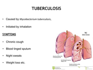 TUBERCULOSIS
• Caused by Mycobacterium tuberculosis,
• Initiated by inhalation
SYMPTOMS
• Chronic cough
• Blood tinged sputum
• Night sweats
• Weight loss etc.
27
 