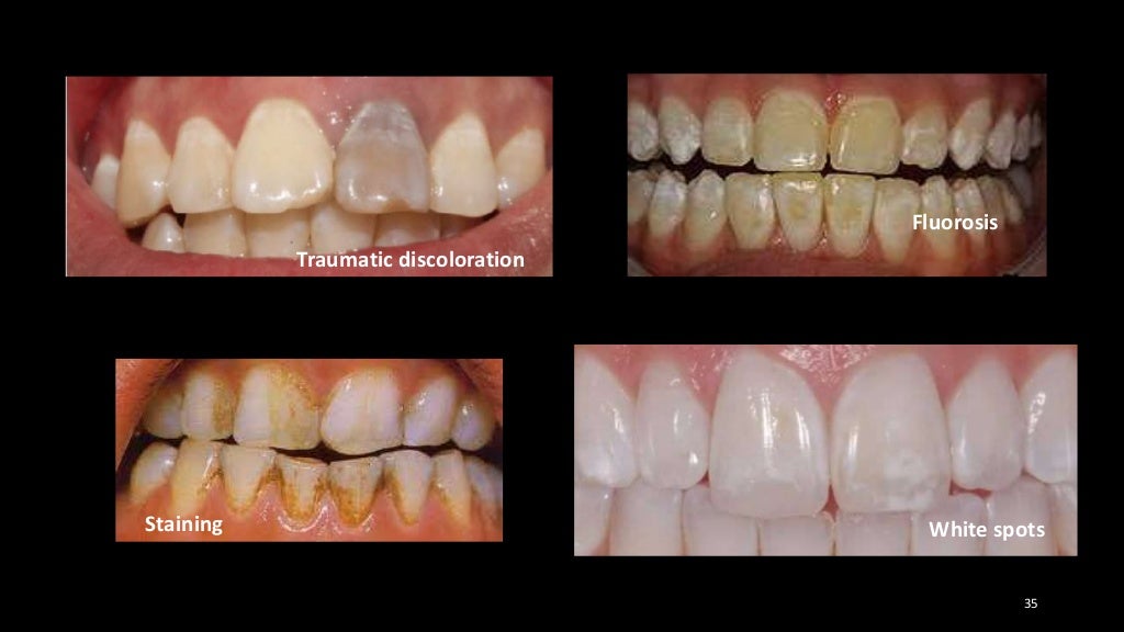 Aesthetic problem solving part 1