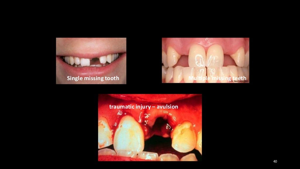 Aesthetic problem solving part 1