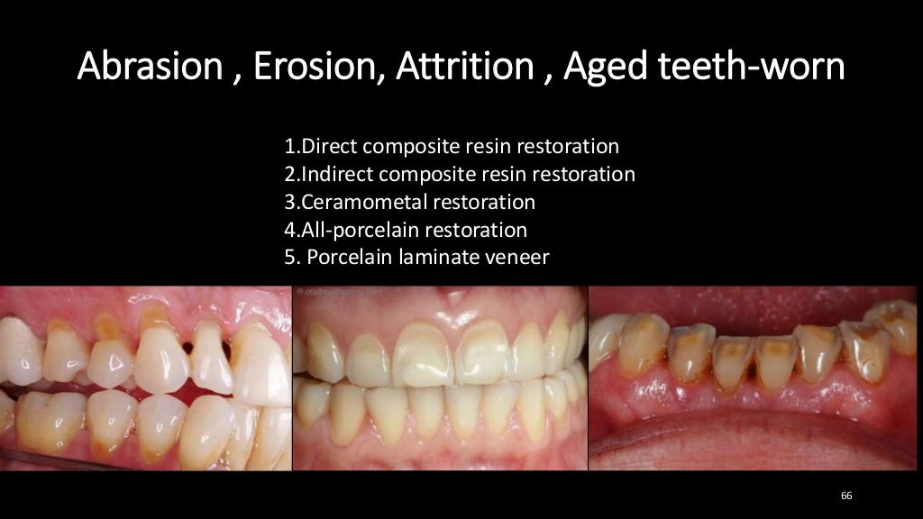 Aesthetic problem solving part 1