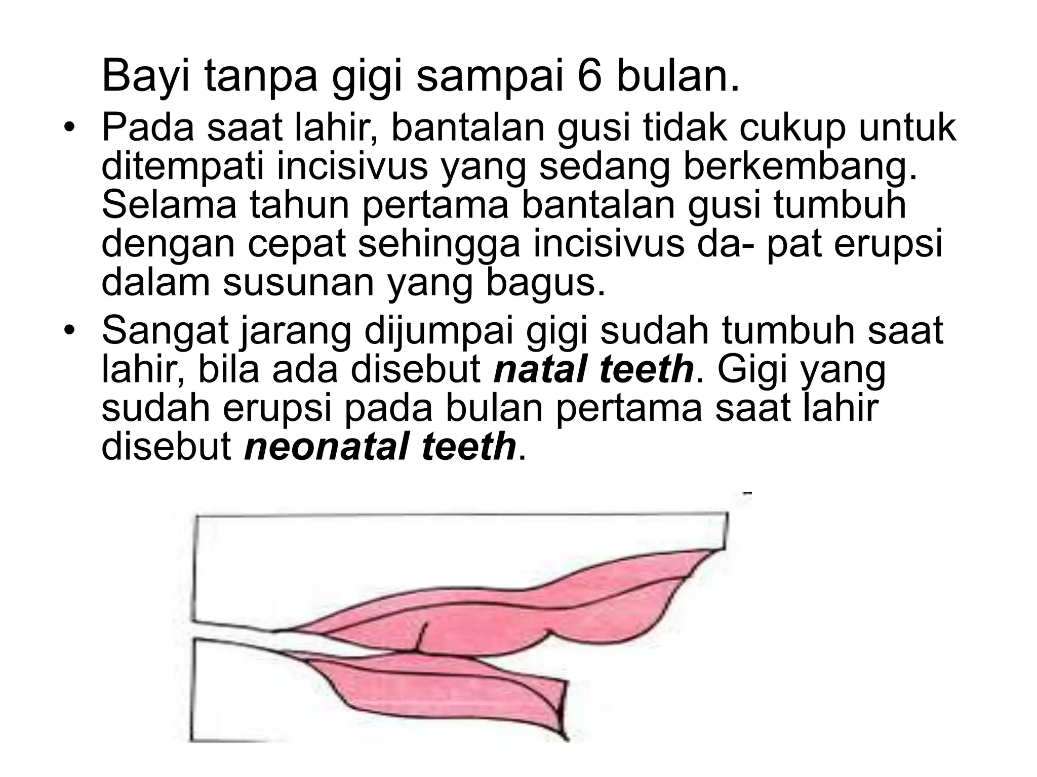 Bayi tanpa gigi sampai 6 bulan.
• Pada saat lahir, bantalan gusi tidak cukup untuk
ditempati incisivus yang sedang berkembang.
Selama tahun pertama bantalan gusi tumbuh
dengan cepat sehingga incisivus da- pat erupsi
dalam susunan yang bagus.
• Sangat jarang dijumpai gigi sudah tumbuh saat
lahir, bila ada disebut natal teeth. Gigi yang
sudah erupsi pada bulan pertama saat lahir
disebut neonatal teeth.
 