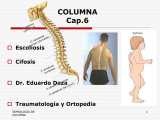 SEMIOLOGIA DE 
COLUMNA 
1 
COLUMNA 
Cap.6 
 Escoliosis 
 Cifosis 
 Dr. Eduardo Deza 
 Traumatología y Ortopedia 
 
