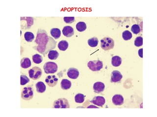 APOPTOSIS
 