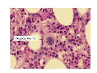 megacariocito
 