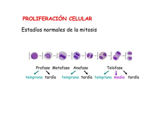 PROLIFERACIÓN CELULAR
Estadíos normales de la mitosis
Profase Metafase Anafase Telofase
temprana tardía temprana tardía temprana media tardía
 