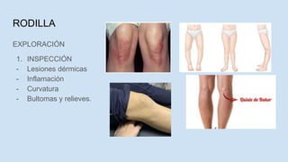 RODILLA
EXPLORACIÓN
1. INSPECCIÓN
- Lesiones dérmicas
- Inflamación
- Curvatura
- Bultomas y relieves.
 