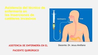 Asistencia del técnico de
enfermería en
las Inserciones de
catéteres invasivos
ASISTENCIA DE ENFERMERÍA EN EL
PACIENTE QUIRÚRGICO
Docente: Dr. Jesus Arellano
 