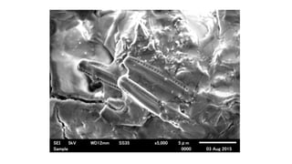 Scanning electron microscope (SEM), TEM | PDF