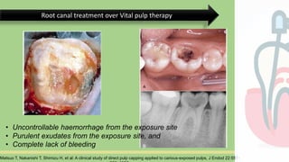 Rationale of endodontics | PPTX