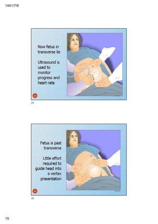 6/7/1441
15
2/29/2029
29
2/29/2030
30
 