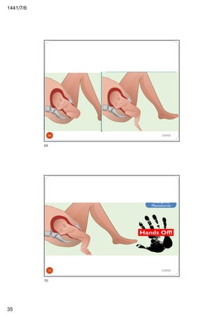 6/7/1441
35
2/29/2069
69
2/29/2070
70
 