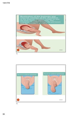 6/7/1441
36
2/29/2071
71
2/29/2072
72
 