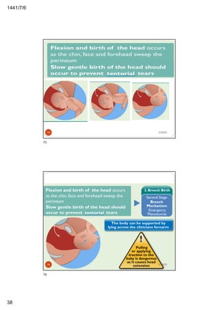 6/7/1441
38
2/29/2075
75
2/29/2076
76
 