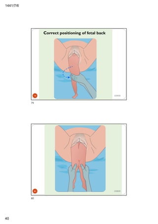 6/7/1441
40
2/29/2079
79
2/29/2080
80
 