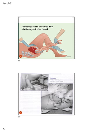 6/7/1441
47
2/29/2093
93
2/29/2094
94
 