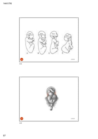 6/7/1441
57
2/29/20113
113
2/29/20114
114
 