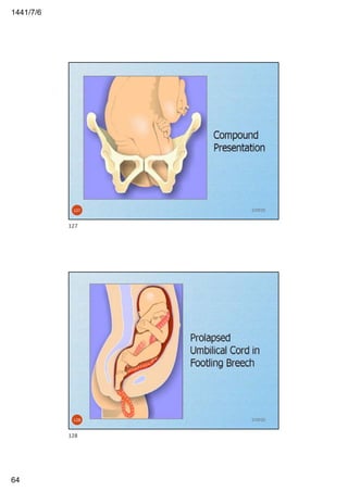 6/7/1441
64
2/29/20127
127
2/29/20128
128
 