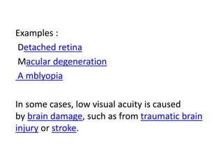 3. visual acuity | PPTX