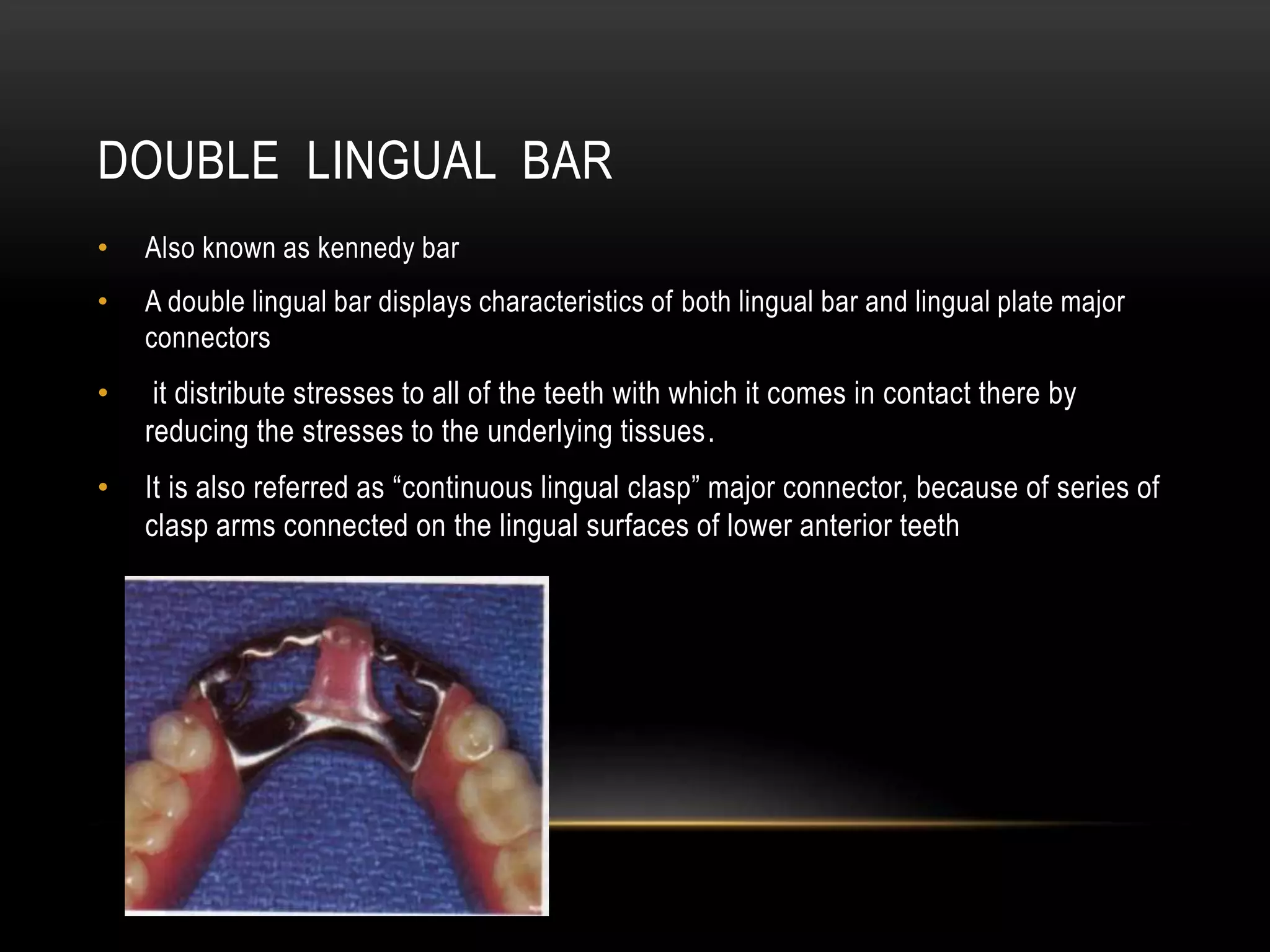 MAJOR CONNECTORS AND MINOR CONNECTORS IN RPD - Dr Prathibha Prasad | PPTX