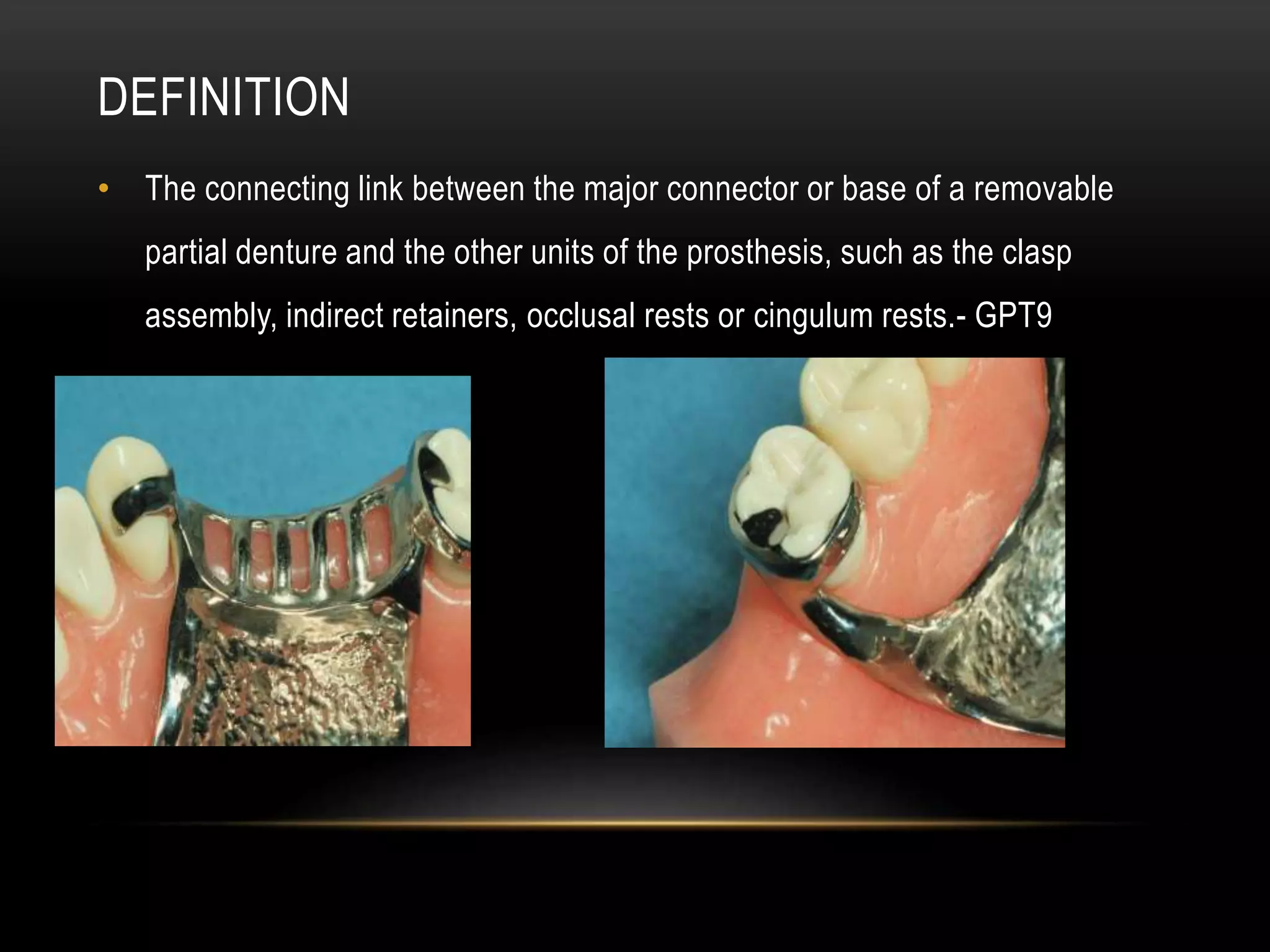 MAJOR CONNECTORS AND MINOR CONNECTORS IN RPD - Dr Prathibha Prasad | PPTX