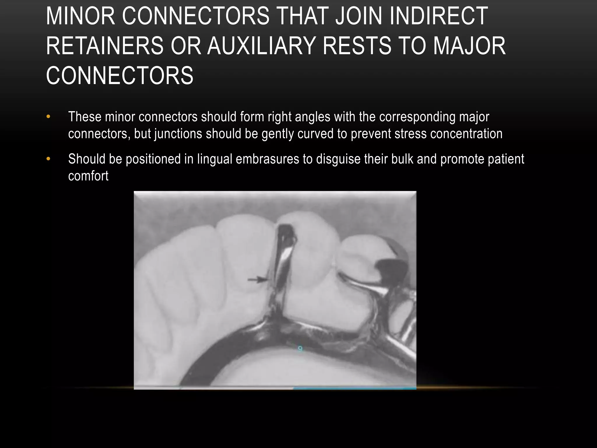 MAJOR CONNECTORS AND MINOR CONNECTORS IN RPD - Dr Prathibha Prasad | PPTX