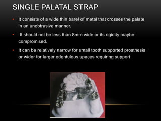 MAJOR CONNECTORS AND MINOR CONNECTORS IN RPD - Dr Prathibha Prasad | PPTX