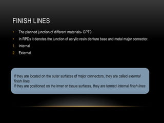 External Finish Line Rpd MAJOR CONNECTORS AND MINOR CONNECTORS IN RPD - Dr Prathibha Prasad | PPTX