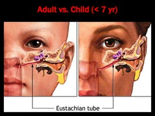Adult vs. Child (< 7 yr)
 