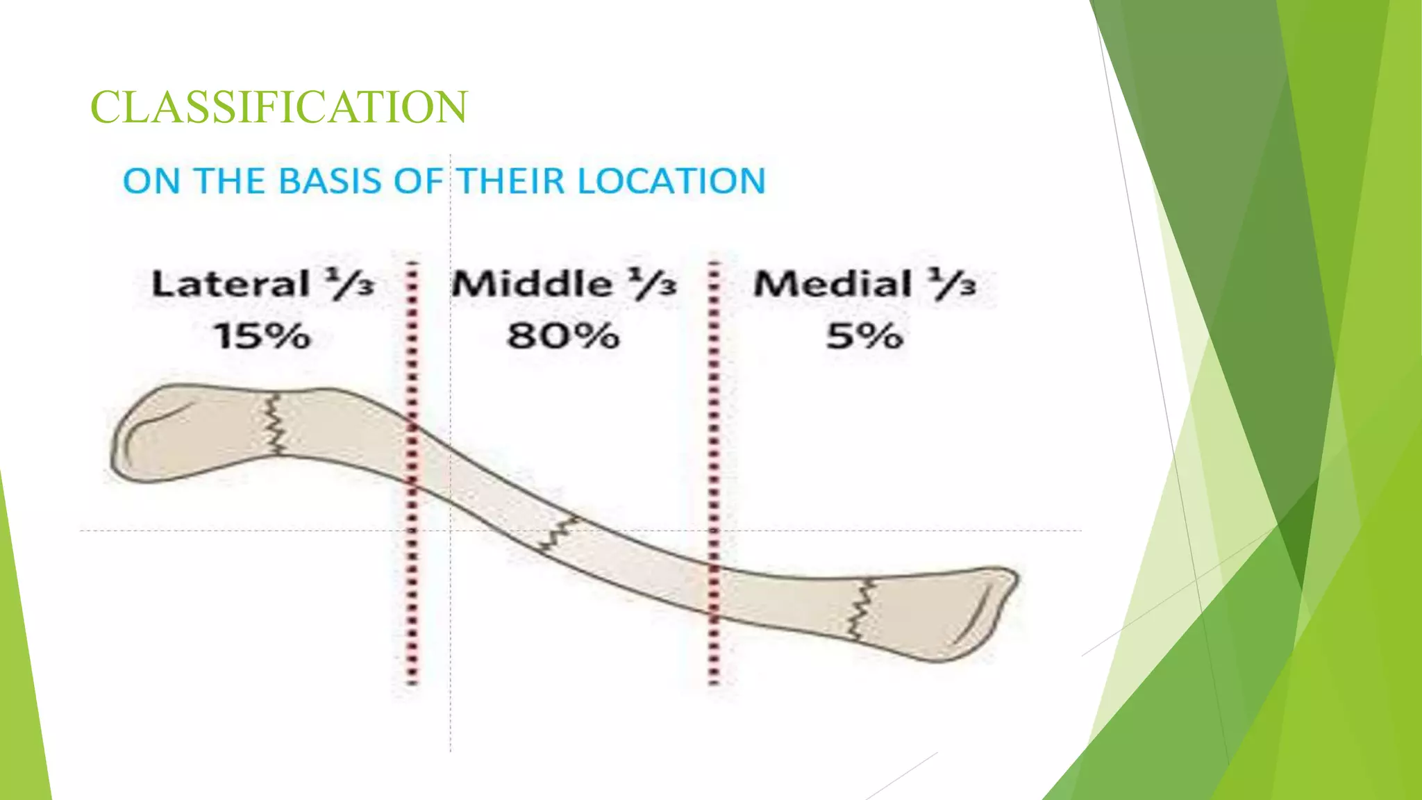 Clavicle fracture and its management | PPTX