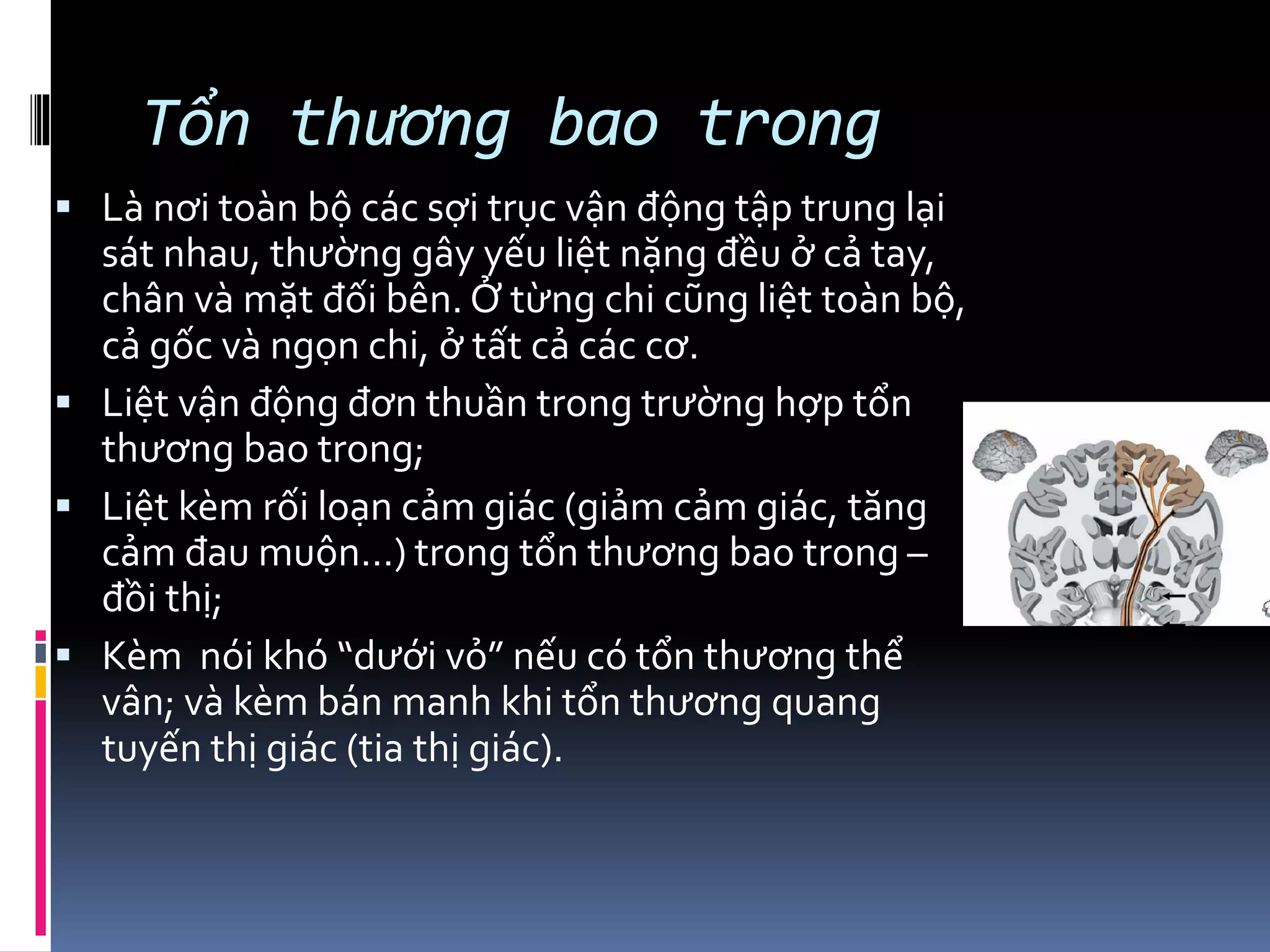 Tổn thương bao trong
▪ Là nơi toàn bộ các sợi trục vận động tập trung lại
sát nhau, thường gây yếu liệt nặng đều ở cả tay,
chân và mặt đối bên. Ở từng chi cũng liệt toàn bộ,
cả gốc và ngọn chi, ở tất cả các cơ.
▪ Liệt vận động đơn thuần trong trường hợp tổn
thương bao trong;
▪ Liệt kèm rối loạn cảm giác (giảm cảm giác, tăng
cảm đau muộn…) trong tổn thương bao trong –
đồi thị;
▪ Kèm nói khó “dưới vỏ” nếu có tổn thương thể
vân; và kèm bán manh khi tổn thương quang
tuyến thị giác (tia thị giác).
 