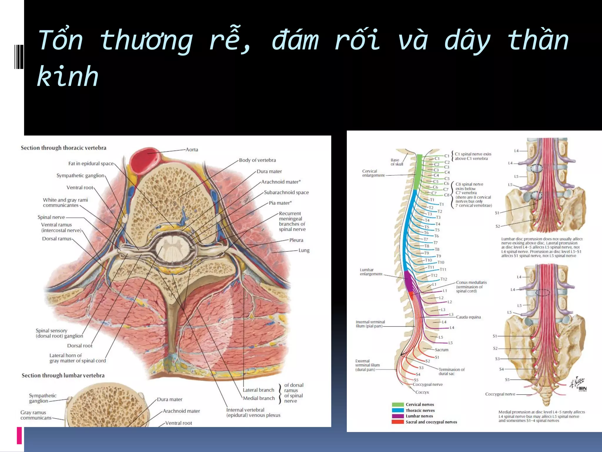 Tổn thương rễ, đám rối và dây thần
kinh
 