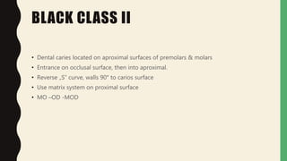 BLACK CLASS II
• Dental caries located on aproximal surfaces of premolars & molars
• Entrance on occlusal surface, then into aproximal.
• Reverse „S“ curve, walls 90° to carios surface
• Use matrix system on proximal surface
• MO –OD -MOD
 