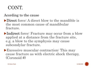 3. mandible fractures