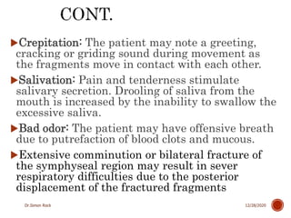 3. mandible fractures