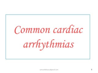 Common cardiac
arrhythmias
1
samueldebassu@gmail.com
 