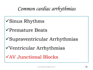 Common Heart Rythmns 3. common cardiac arrythemias | PPTX