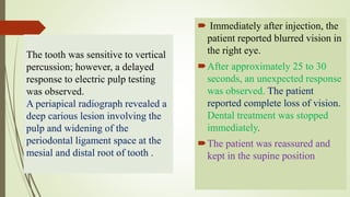  Immediately after injection, the
patient reported blurred vision in
the right eye.
After approximately 25 to 30
seconds, an unexpected response
was observed. The patient
reported complete loss of vision.
Dental treatment was stopped
immediately.
The patient was reassured and
kept in the supine position
The tooth was sensitive to vertical
percussion; however, a delayed
response to electric pulp testing
was observed.
A periapical radiograph revealed a
deep carious lesion involving the
pulp and widening of the
periodontal ligament space at the
mesial and distal root of tooth .
 