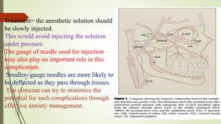Treatment= the anesthetic solution should
be slowly injected.
This would avoid injecting the solution
under pressure.
The gauge of needle used for injection
may also play an important role in this
complication.
Smaller- gauge needles are more likely to
be deflected as they pass through tissues.
The clinician can try to minimize the
potential for such complications through
effective anxiety management .
 