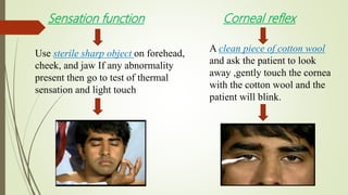 Sensation function
Use sterile sharp object on forehead,
cheek, and jaw If any abnormality
present then go to test of thermal
sensation and light touch
Corneal reflex
A clean piece of cotton wool
and ask the patient to look
away ,gently touch the cornea
with the cotton wool and the
patient will blink.
 