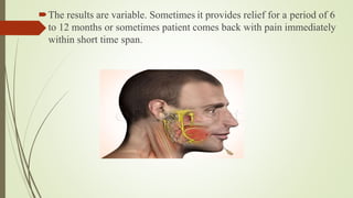 The results are variable. Sometimes it provides relief for a period of 6
to 12 months or sometimes patient comes back with pain immediately
within short time span.
 