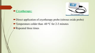Cryotherapy:
Direct application of cryotherapy probe (nitrous oxide probe)
Temperature colder than -60 ºC for 2-3 minutes
Repeated three times
 