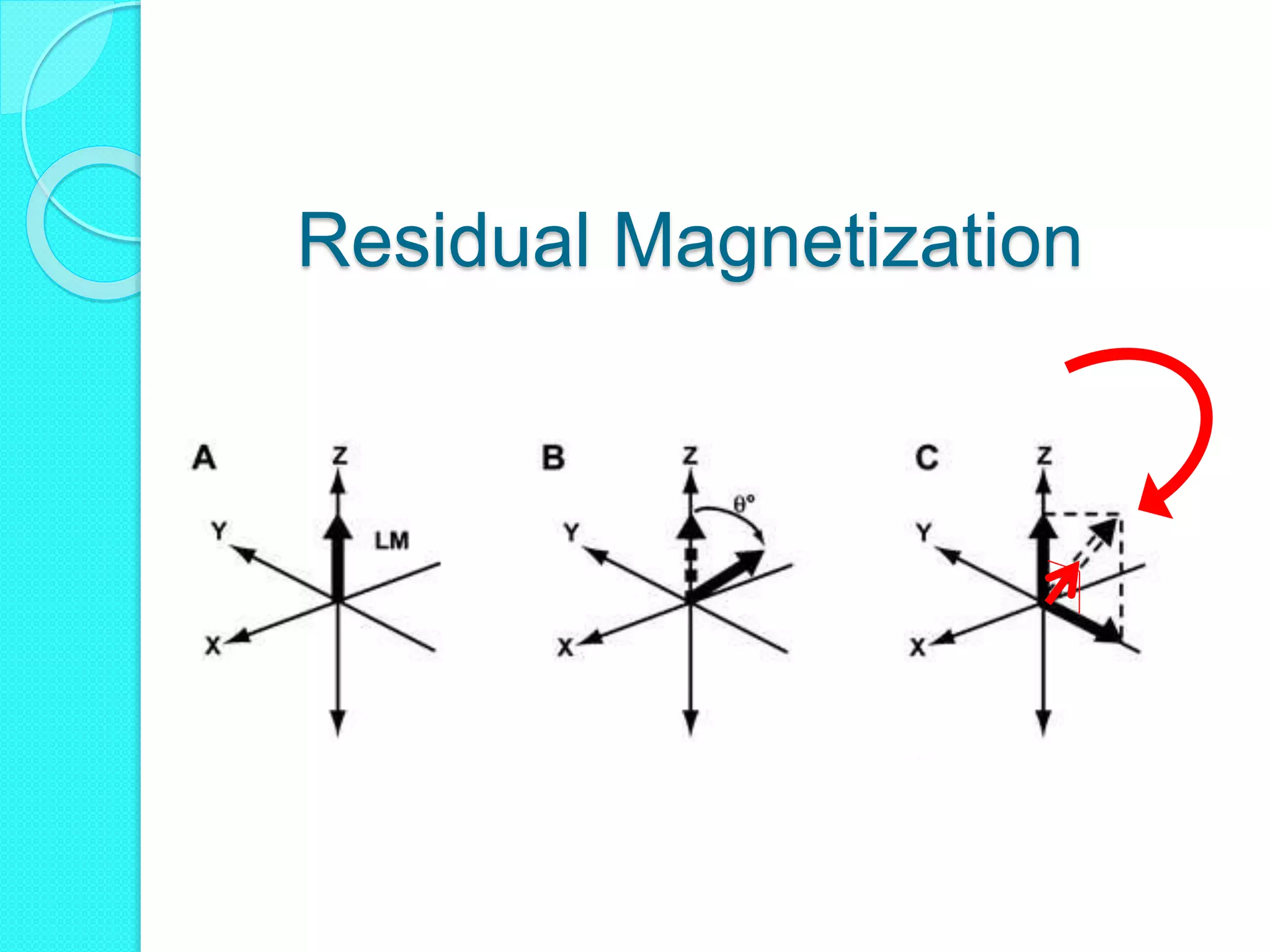Steady State Free Precession MRA | PPTX